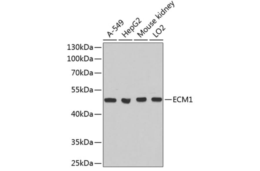 Western Blot - Anti-ECM1 Antibody (A1513) - Antibodies.com