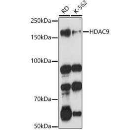 Western Blot - Anti-HDAC9 Antibody (A13481) - Antibodies.com