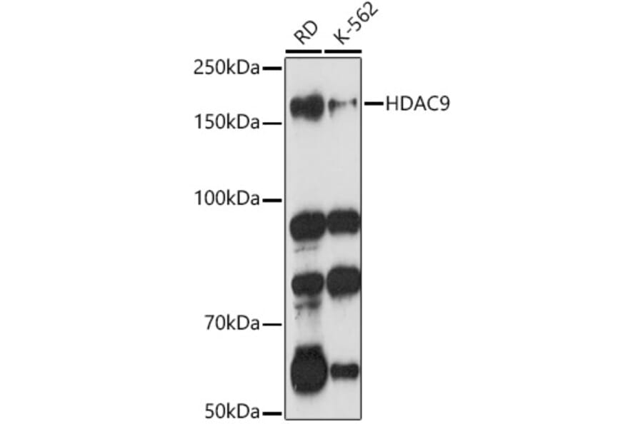 Western Blot - Anti-HDAC9 Antibody (A13481) - Antibodies.com