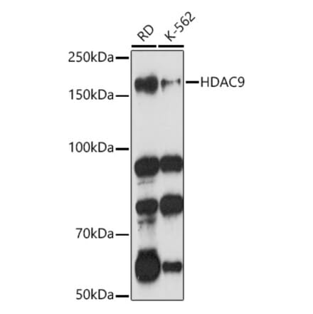 Western Blot - Anti-HDAC9 Antibody (A13481) - Antibodies.com