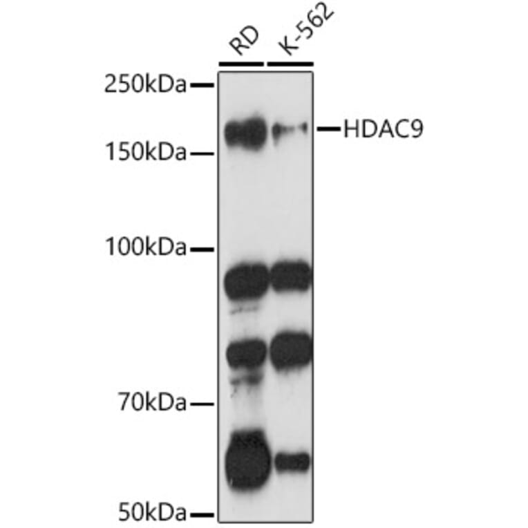 Western Blot - Anti-HDAC9 Antibody (A13481) - Antibodies.com
