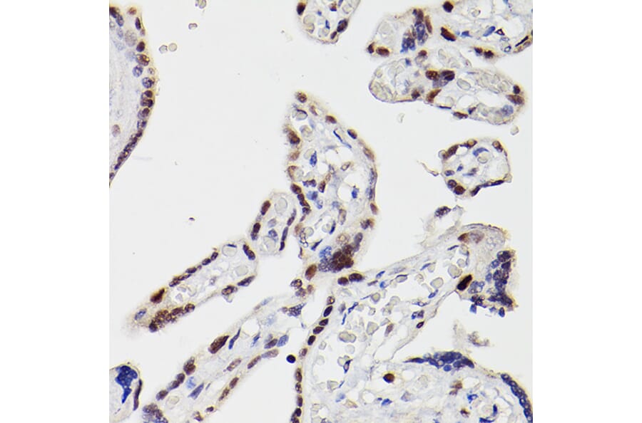 Immunohistochemistry - Anti-HDAC9 Antibody (A13481) - Antibodies.com