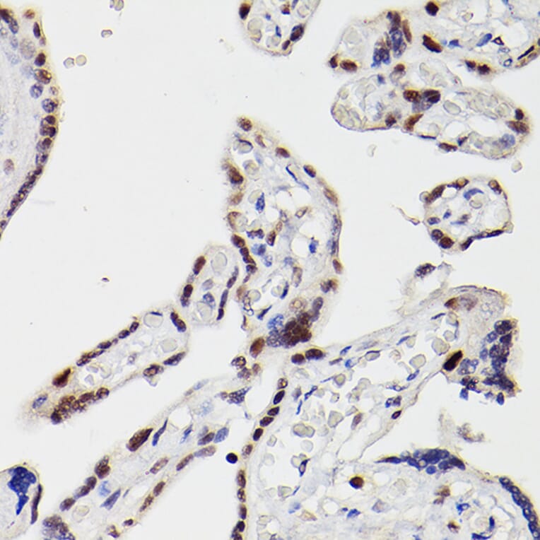 Immunohistochemistry - Anti-HDAC9 Antibody (A13481) - Antibodies.com