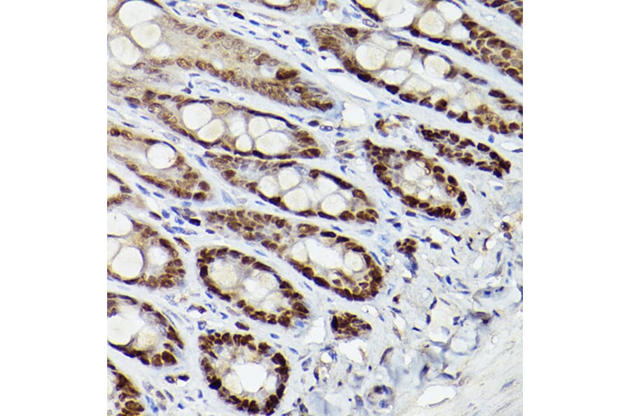 Immunohistochemistry - Anti-HDAC9 Antibody (A13481) - Antibodies.com