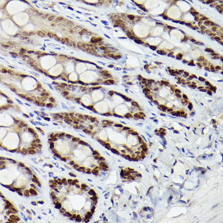 Immunohistochemistry - Anti-HDAC9 Antibody (A13481) - Antibodies.com