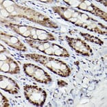 Immunohistochemistry - Anti-HDAC9 Antibody (A13481) - Antibodies.com
