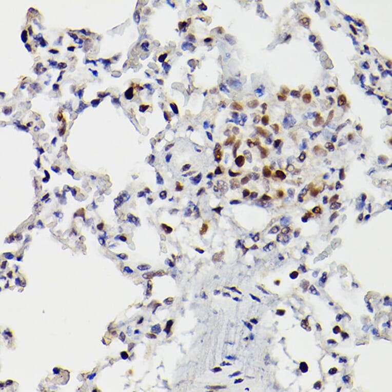 Immunohistochemistry - Anti-HDAC9 Antibody (A13481) - Antibodies.com
