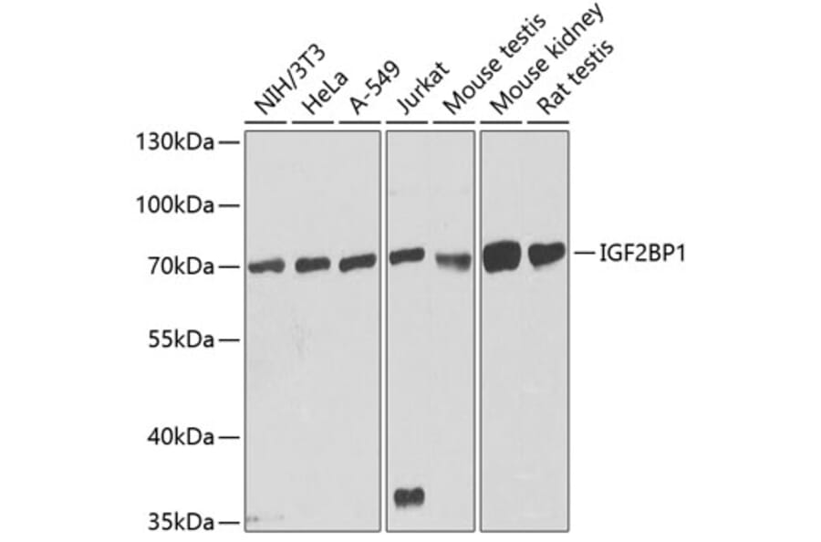 Western Blot - Anti-IGF2BP1/IMP1 Antibody (A13482) - Antibodies.com