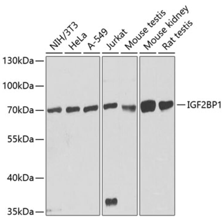 Western Blot - Anti-IGF2BP1/IMP1 Antibody (A13482) - Antibodies.com