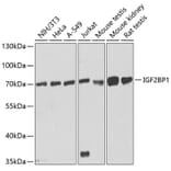 Western Blot - Anti-IGF2BP1/IMP1 Antibody (A13482) - Antibodies.com