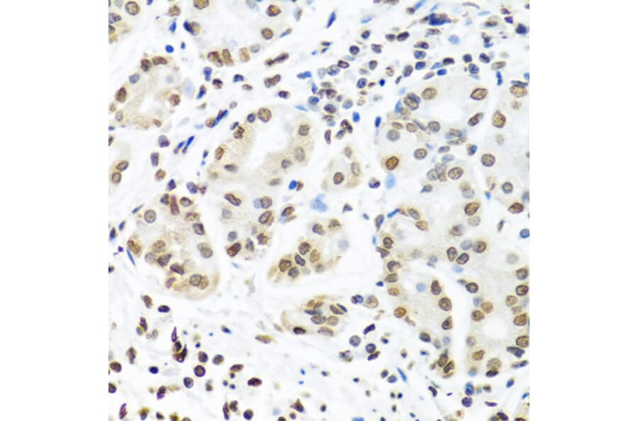Immunohistochemistry - Anti-IGF2BP1/IMP1 Antibody (A13482) - Antibodies.com