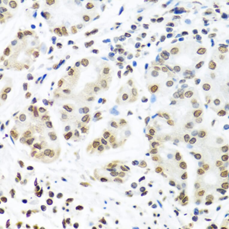 Immunohistochemistry - Anti-IGF2BP1/IMP1 Antibody (A13482) - Antibodies.com