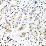 Immunohistochemistry - Anti-IGF2BP1/IMP1 Antibody (A13482) - Antibodies.com