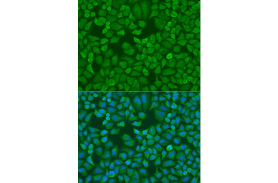 Immunofluorescence - Anti-IGF2BP1/IMP1 Antibody (A13482) - Antibodies.com