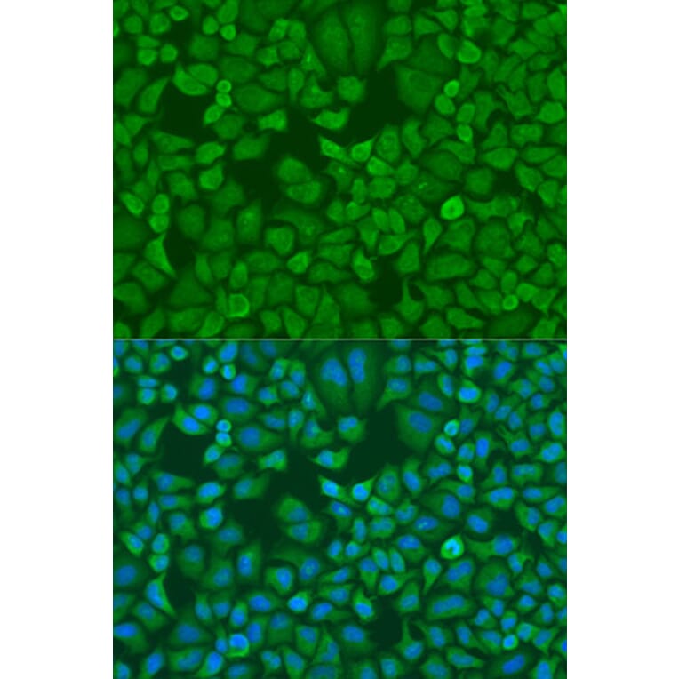 Immunofluorescence - Anti-IGF2BP1/IMP1 Antibody (A13482) - Antibodies.com