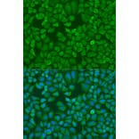 Immunofluorescence - Anti-IGF2BP1/IMP1 Antibody (A13482) - Antibodies.com