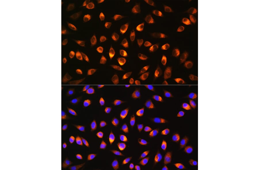 Immunofluorescence - Anti-NQO1 Antibody (A13483) - Antibodies.com