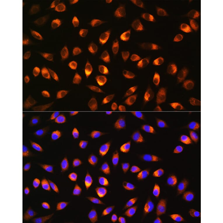 Immunofluorescence - Anti-NQO1 Antibody (A13483) - Antibodies.com