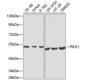 Western Blot - Anti-PICK1 Antibody (A13484) - Antibodies.com