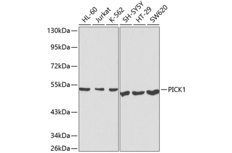 Western Blot - Anti-PICK1 Antibody (A13484) - Antibodies.com