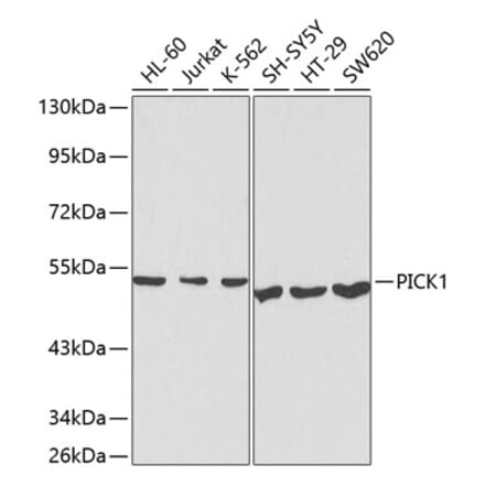 Western Blot - Anti-PICK1 Antibody (A13484) - Antibodies.com