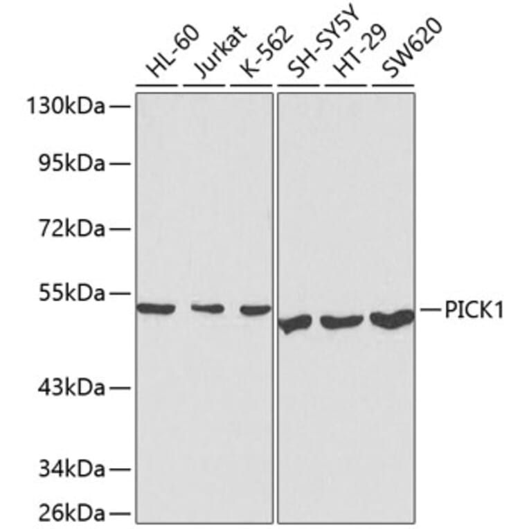 Western Blot - Anti-PICK1 Antibody (A13484) - Antibodies.com