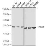 Western Blot - Anti-PICK1 Antibody (A13484) - Antibodies.com