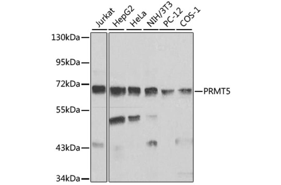 Western Blot - Anti-PRMT5 Antibody (A13485) - Antibodies.com