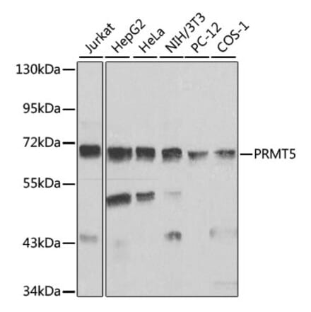 Western Blot - Anti-PRMT5 Antibody (A13485) - Antibodies.com