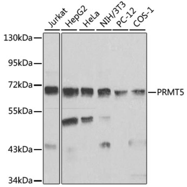 Western Blot - Anti-PRMT5 Antibody (A13485) - Antibodies.com