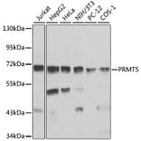 Western Blot - Anti-PRMT5 Antibody (A13485) - Antibodies.com