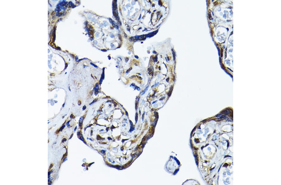 Immunohistochemistry - Anti-PRMT5 Antibody (A13485) - Antibodies.com