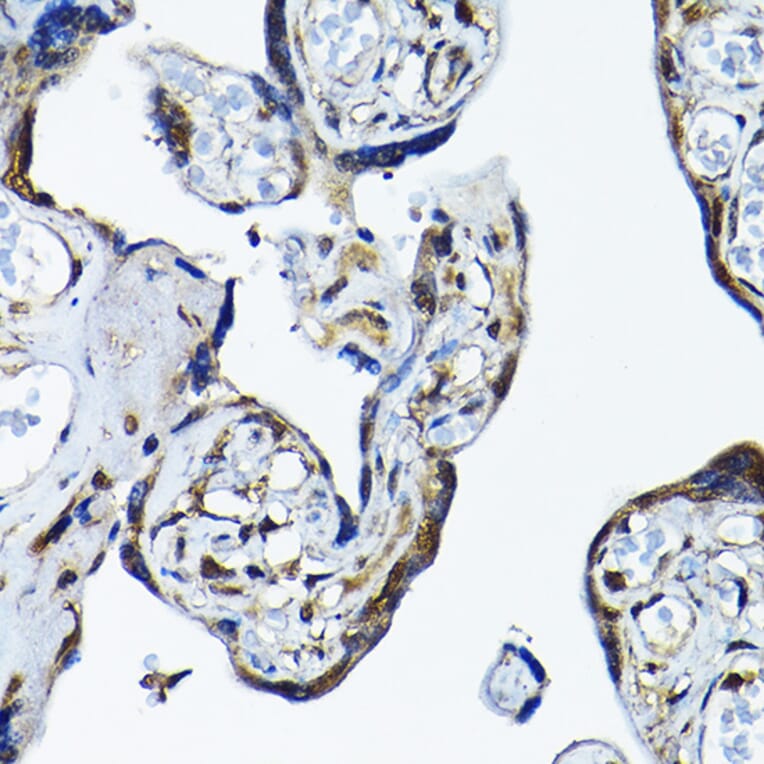 Immunohistochemistry - Anti-PRMT5 Antibody (A13485) - Antibodies.com