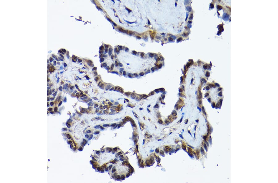 Immunohistochemistry - Anti-PRMT5 Antibody (A13485) - Antibodies.com