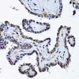 Immunohistochemistry - Anti-PRMT5 Antibody (A13485) - Antibodies.com