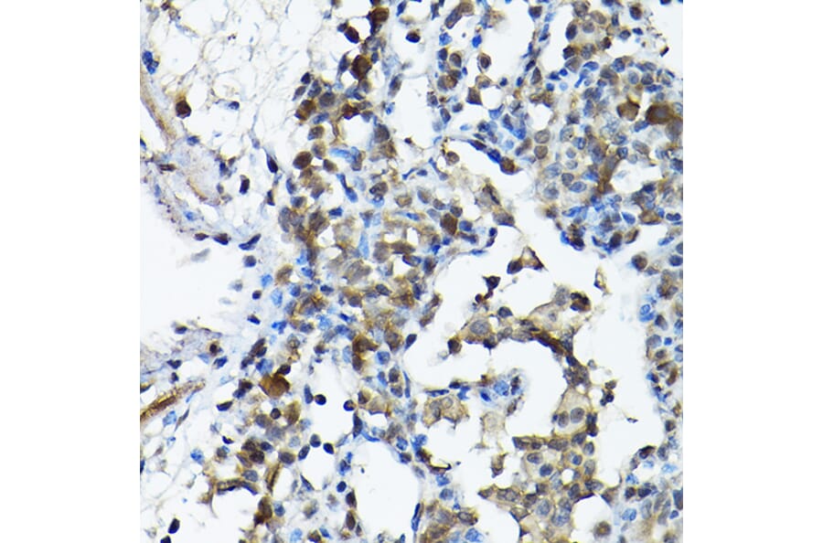 Immunohistochemistry - Anti-PRMT5 Antibody (A13485) - Antibodies.com
