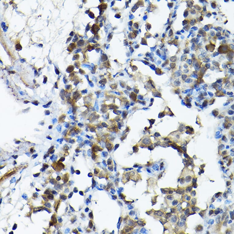 Immunohistochemistry - Anti-PRMT5 Antibody (A13485) - Antibodies.com