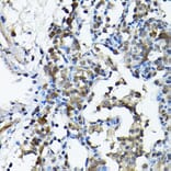 Immunohistochemistry - Anti-PRMT5 Antibody (A13485) - Antibodies.com
