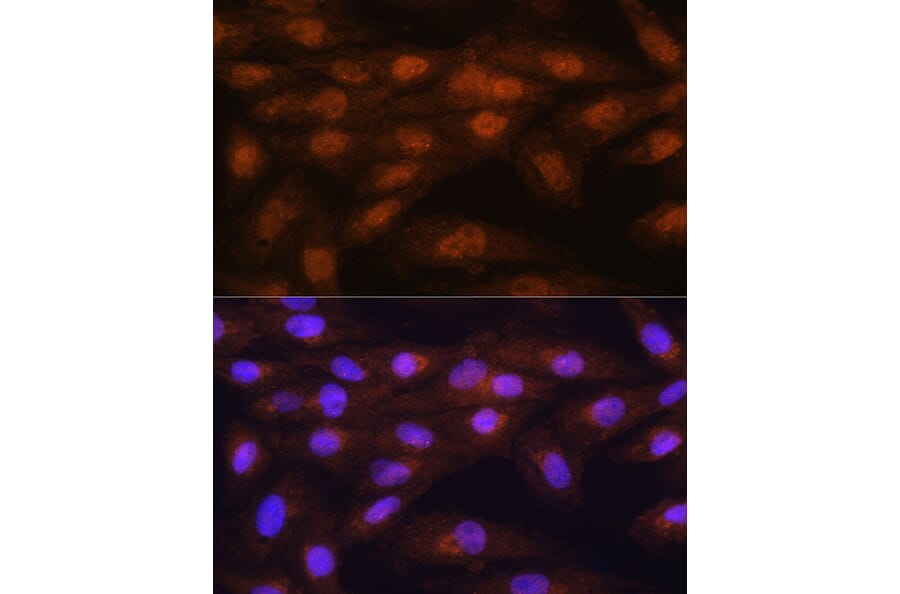 Immunofluorescence - Anti-PRMT5 Antibody (A13485) - Antibodies.com
