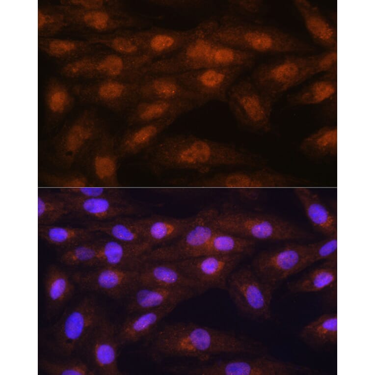 Immunofluorescence - Anti-PRMT5 Antibody (A13485) - Antibodies.com