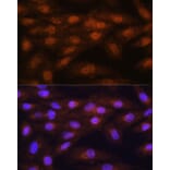 Immunofluorescence - Anti-PRMT5 Antibody (A13485) - Antibodies.com