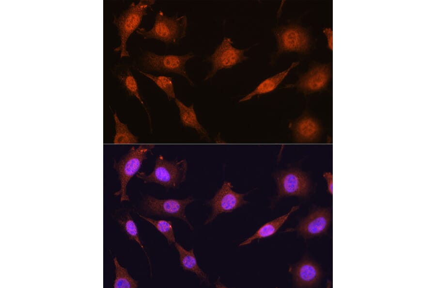 Immunofluorescence - Anti-PRMT5 Antibody (A13485) - Antibodies.com
