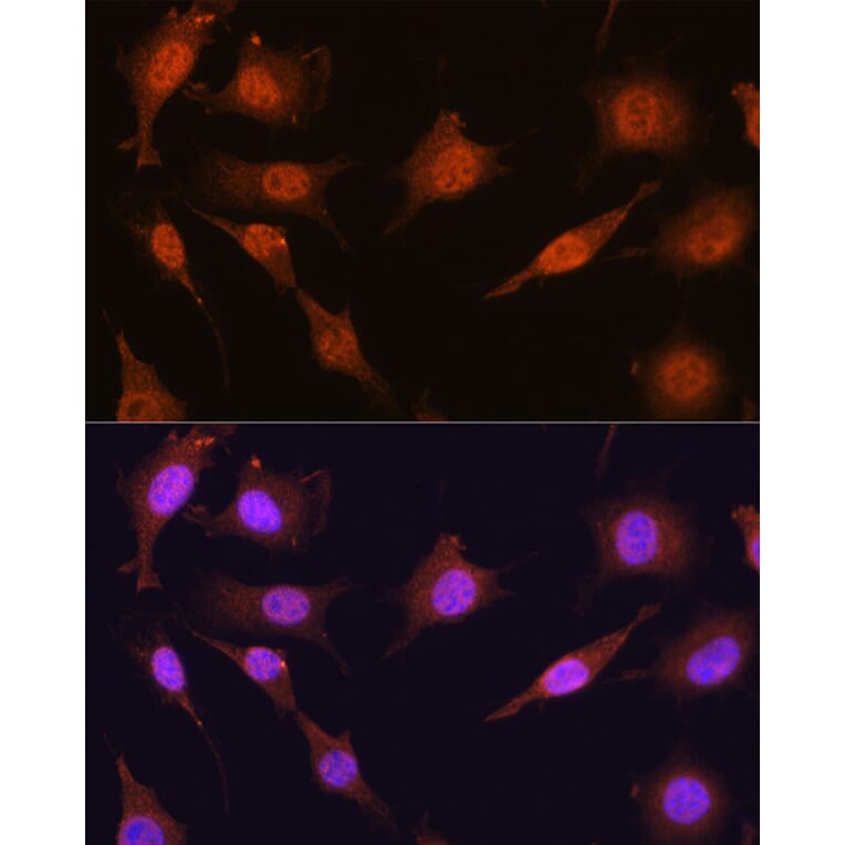Immunofluorescence - Anti-PRMT5 Antibody (A13485) - Antibodies.com