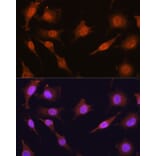 Immunofluorescence - Anti-PRMT5 Antibody (A13485) - Antibodies.com