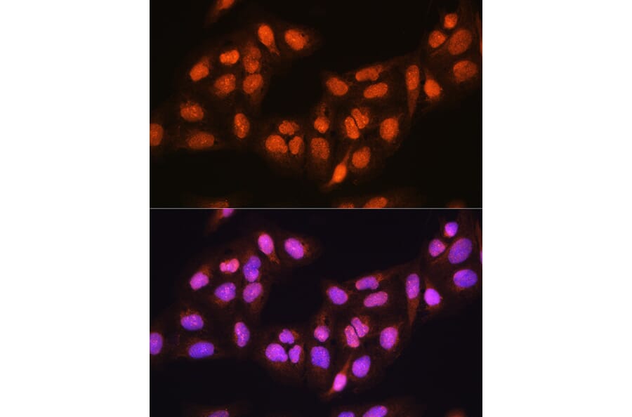 Immunofluorescence - Anti-PRMT5 Antibody (A13485) - Antibodies.com