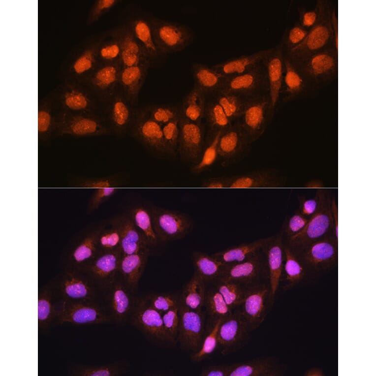 Immunofluorescence - Anti-PRMT5 Antibody (A13485) - Antibodies.com