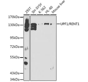 Western Blot - Anti-RENT1/hUPF1 Antibody (A13486) - Antibodies.com