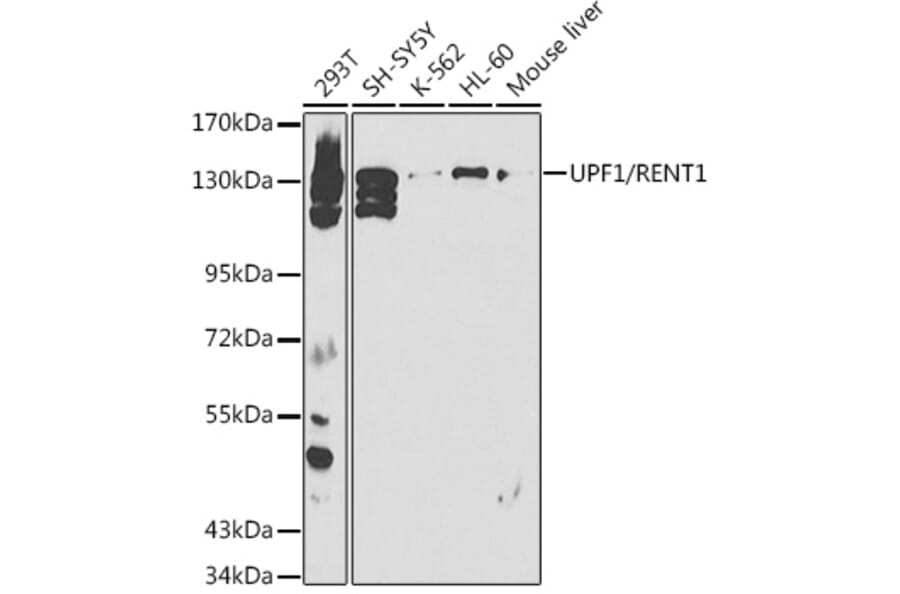 Western Blot - Anti-RENT1/hUPF1 Antibody (A13486) - Antibodies.com