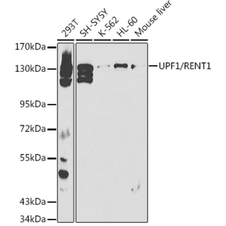 Western Blot - Anti-RENT1/hUPF1 Antibody (A13486) - Antibodies.com