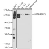 Western Blot - Anti-RENT1/hUPF1 Antibody (A13486) - Antibodies.com